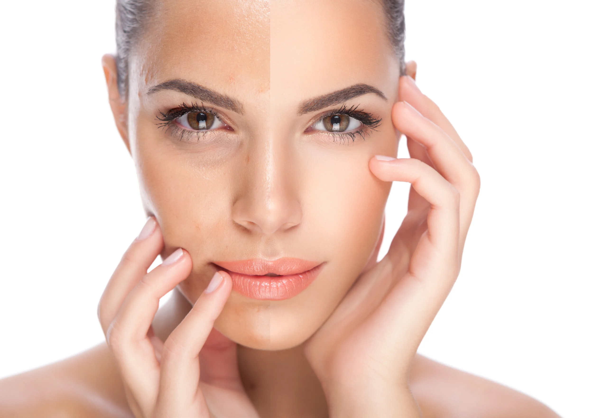 Close-up of a woman with clear skin, touching her face gently, with a split image showing before and after skincare.