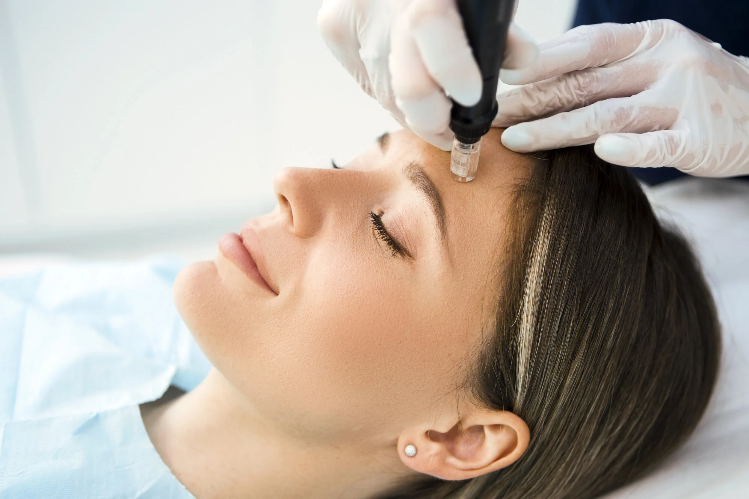 A woman receiving a cosmetic injection on her forehead from a healthcare professional wearing gloves.