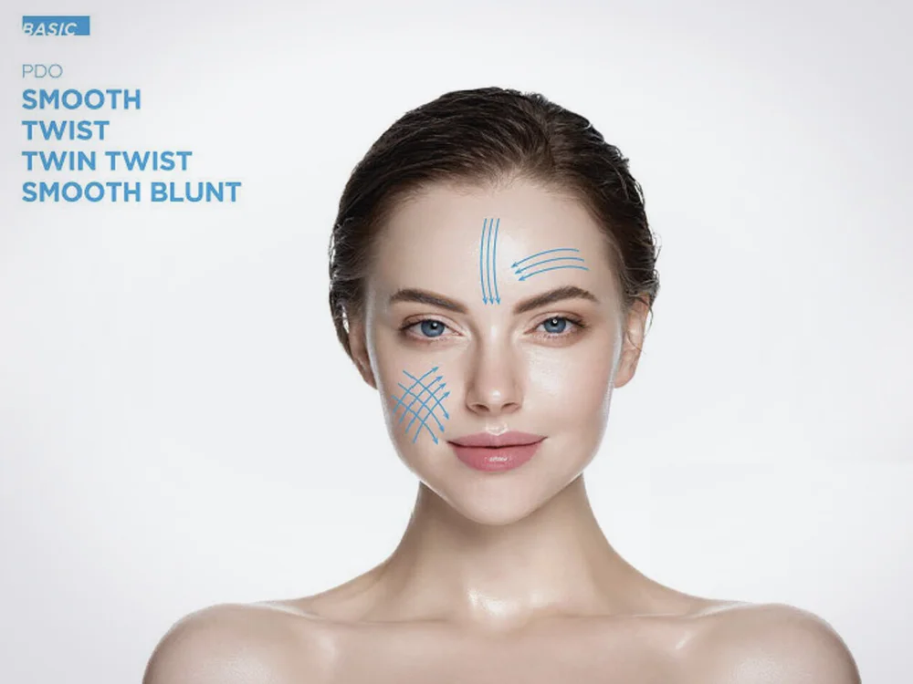 PDO Thread Lift in Calabasas | Dr. Erin Gordon Aesthetics — Dr. Erin ...