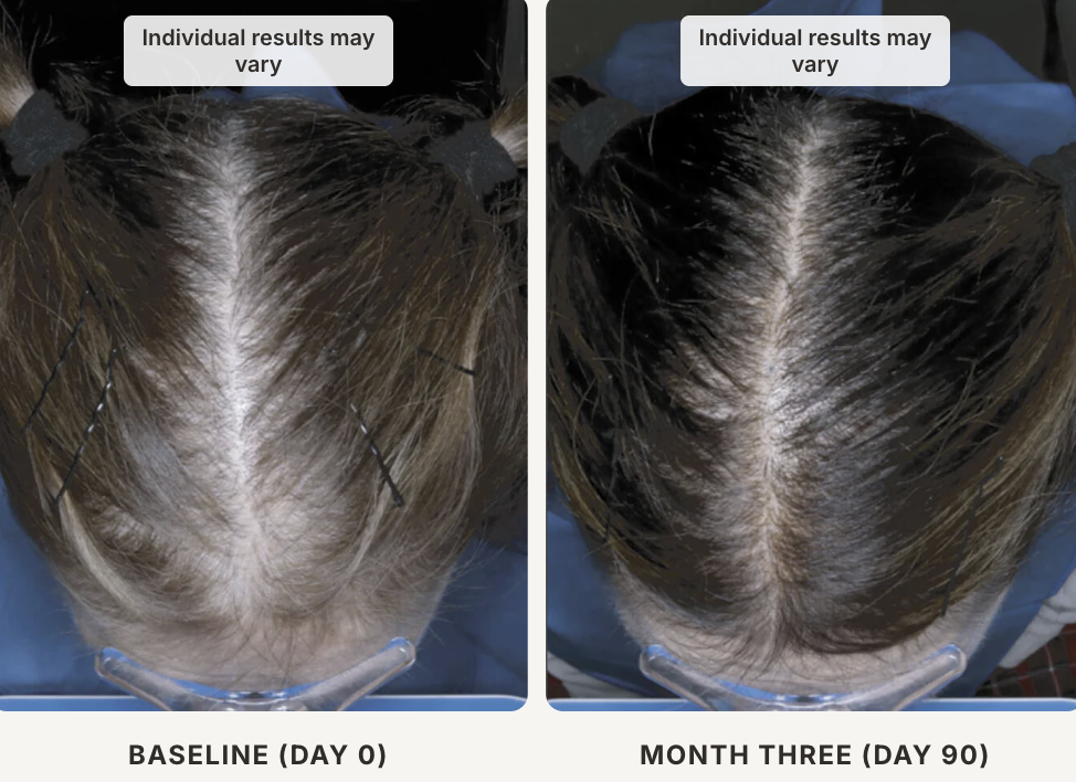 xtresse serum b efore and after