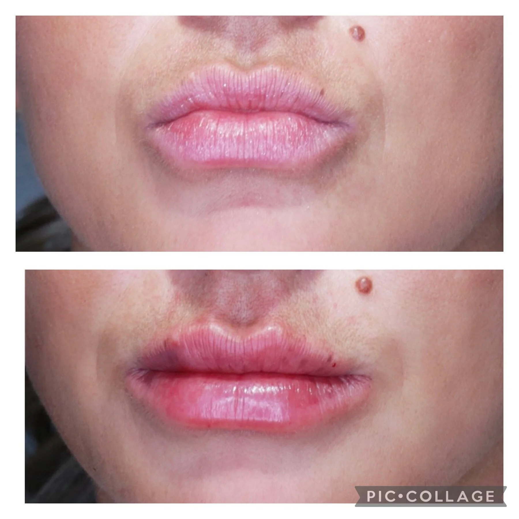 Gallery 1 — Dr. Erin Gordon Aesthetics