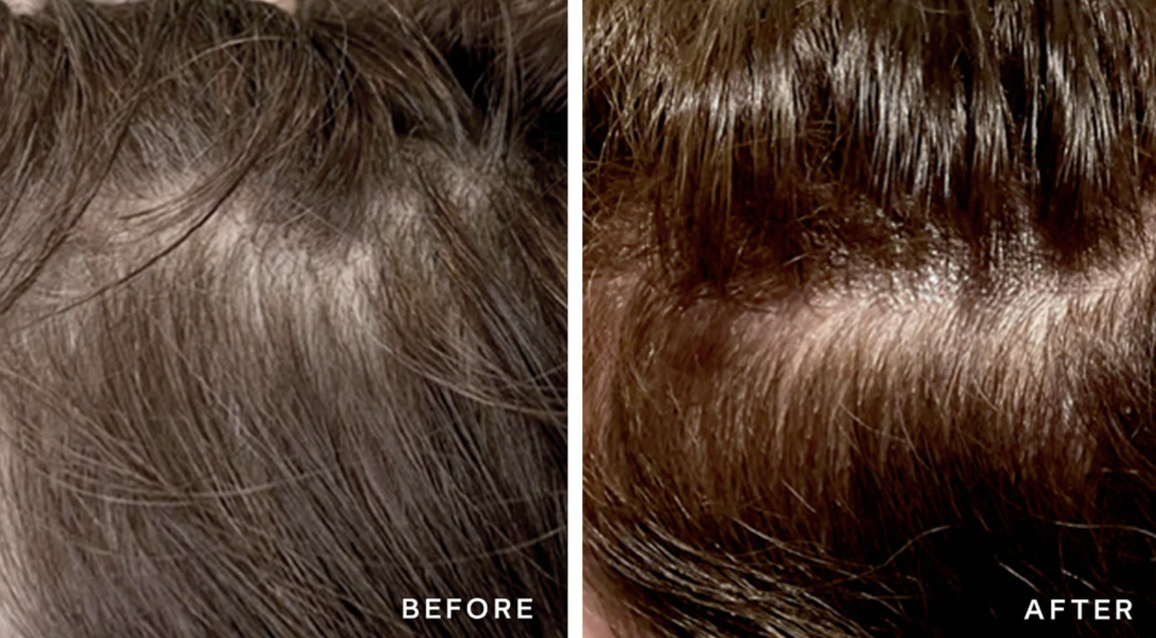 before and after xtresse