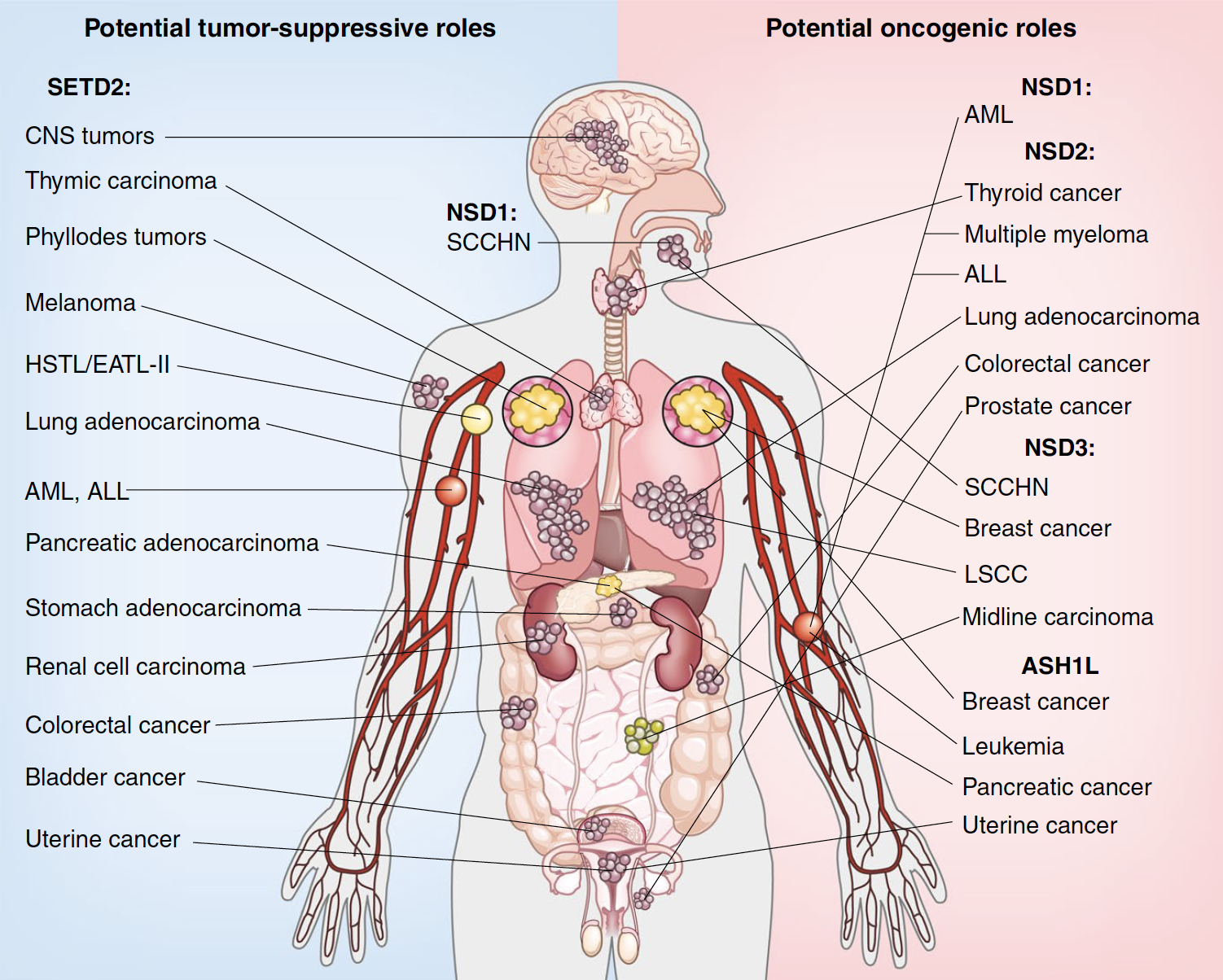 NSDs in cancer schematic.png