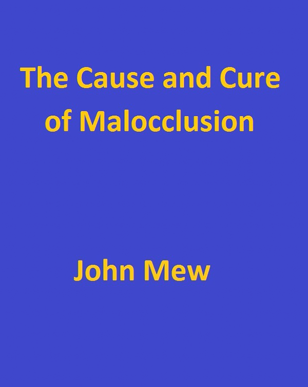 The Cause and Cure of Malocclusion by John Mew