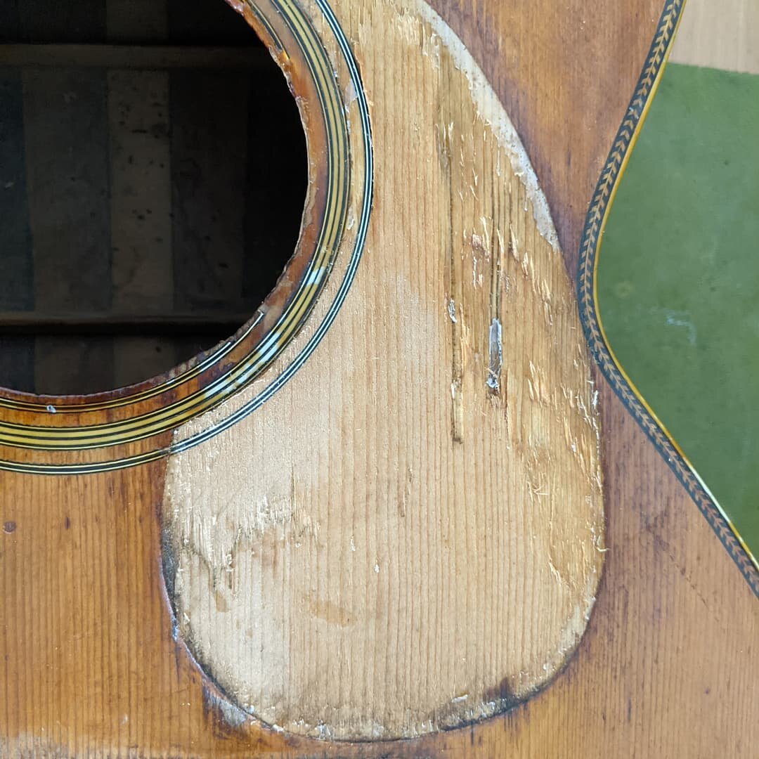 This '44 Martin 000-28 had a BUNCH of awful repairs done in the 1960s. Here you can see where someone*injected* glue under the pickguard in two locations.