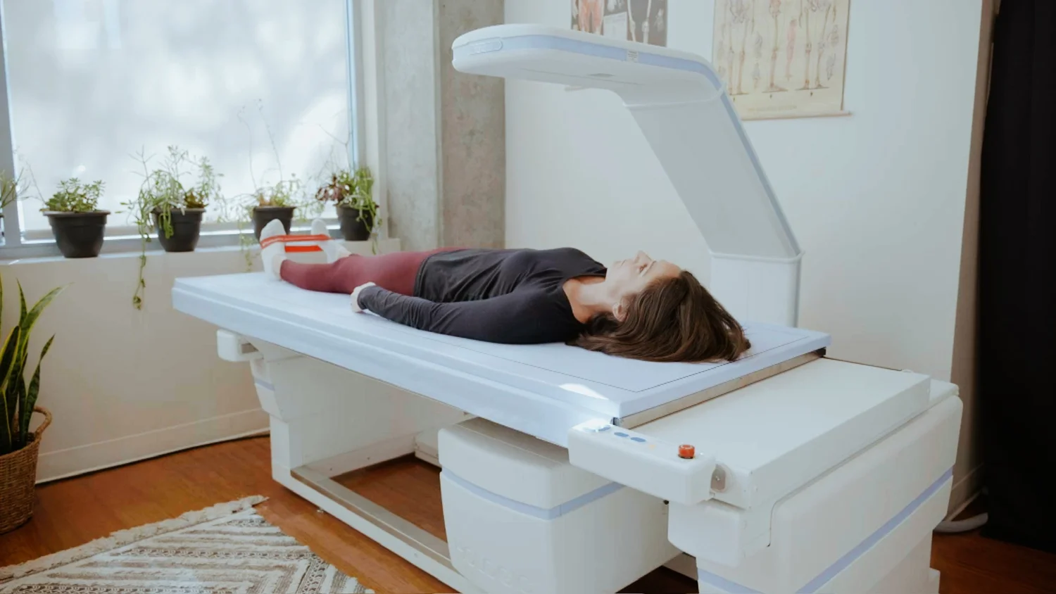 DEXA SF