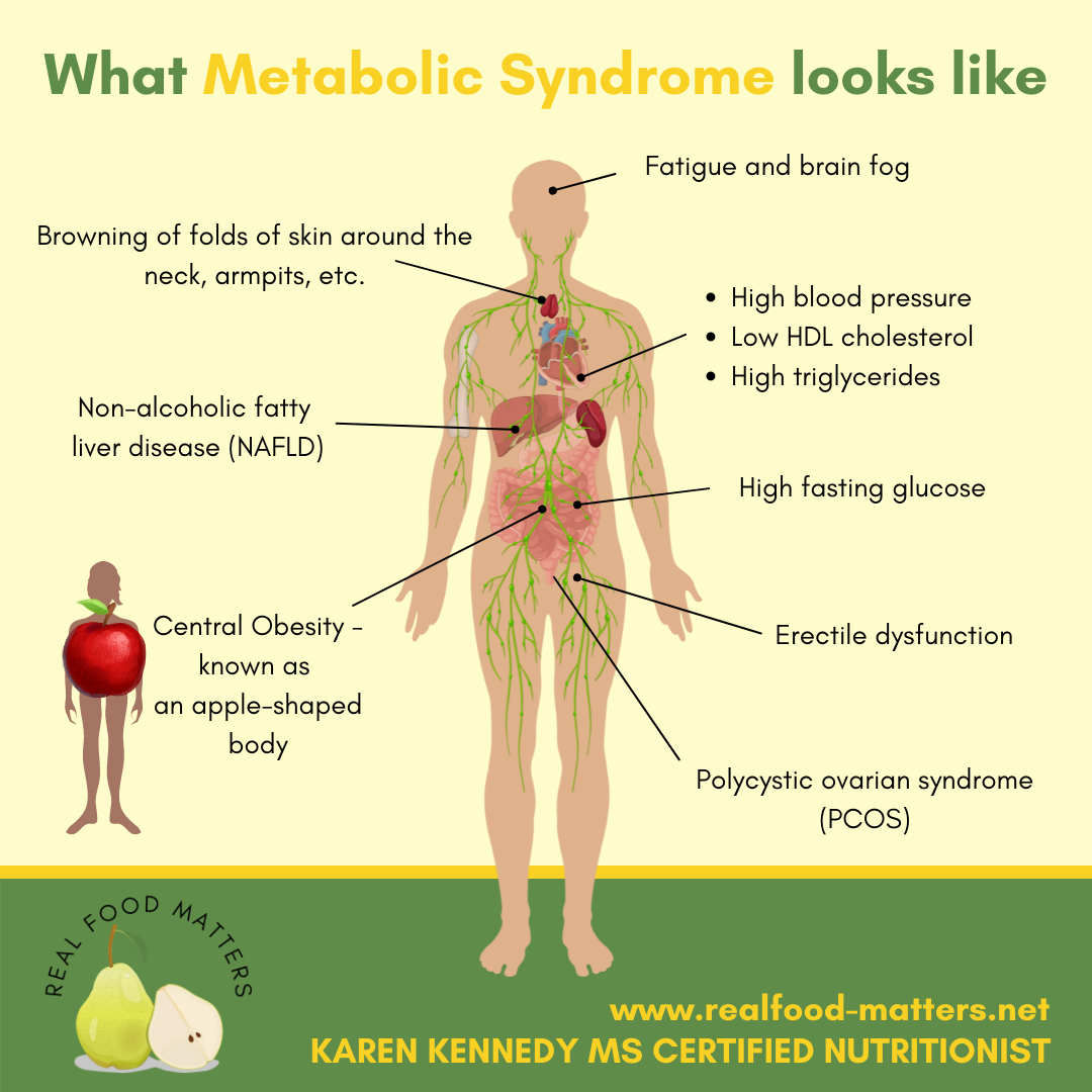 Why Should I Lose Belly Fat? — Karen Kennedy - Real Food Matters
