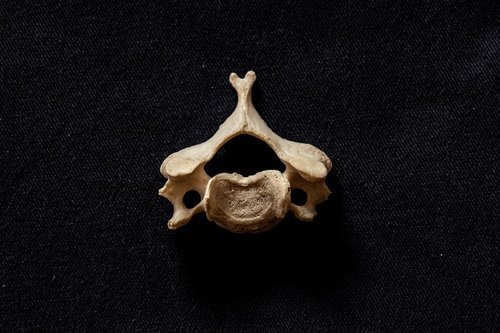 What is Chiropractic?