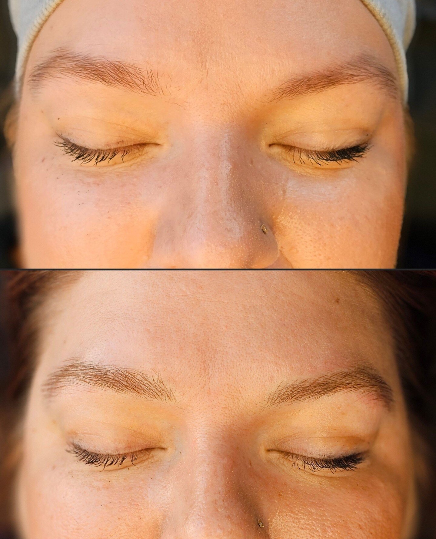 Before and after initial microblade session, swipe to see when we added some powder shading for more definition in her shape! Love to build a brow with you!