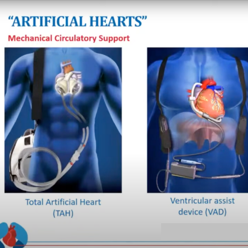 Introduction to Artificial Hearts