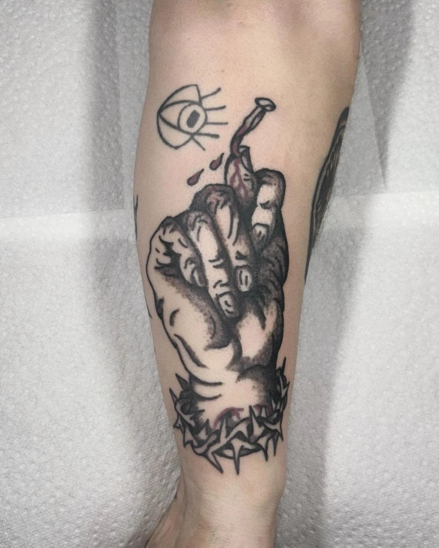 Two new ones from last week, one above a healed one and also a separate picture of a healed one