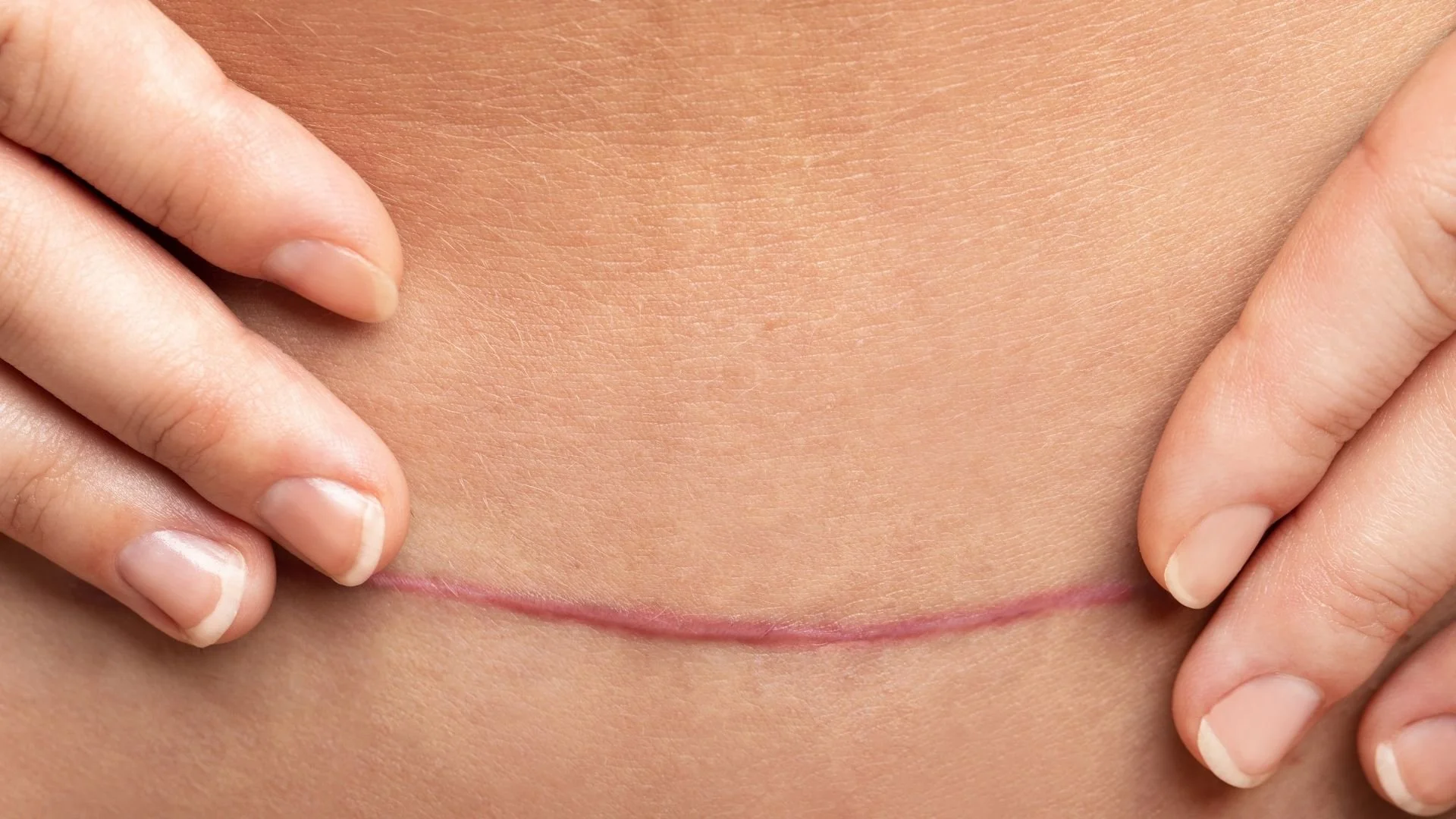Why Unexpected Birth Experiences Can Be So Hard to Process