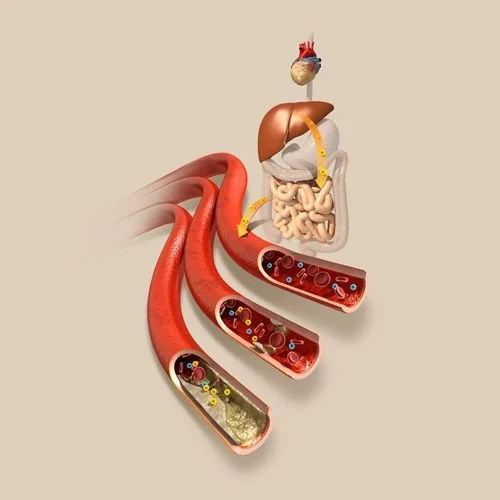 All Things Cholesterol