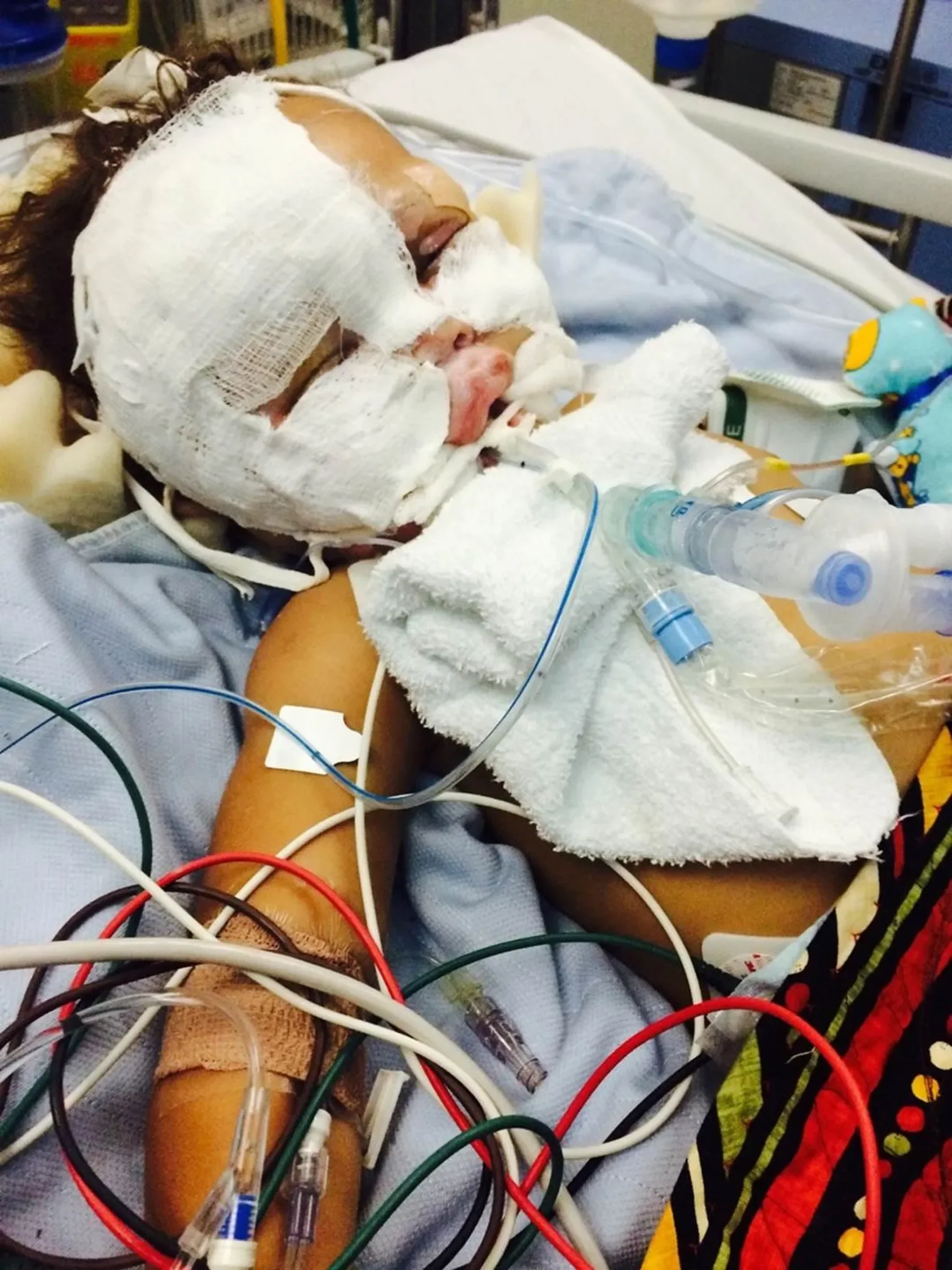 $12.3MM Verdict - Porter v United States