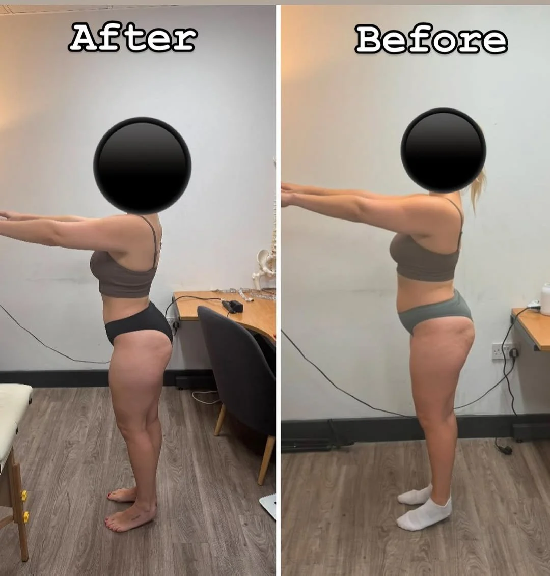 Three months of transformation in the making! When I started working with this client, our goal was clear—build strength, support weight loss, and correct postural imbalances.Through assessment, we identified that her .jpg