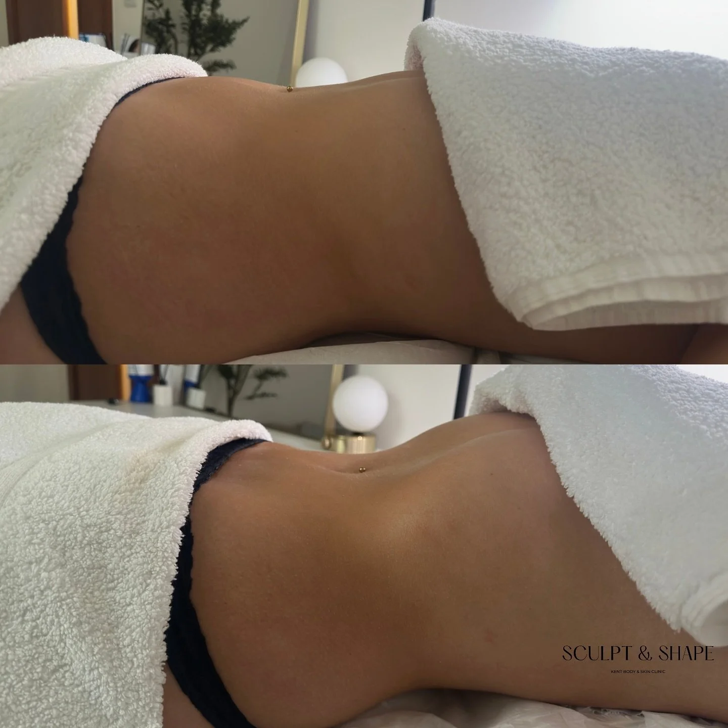 The ultimate drain + detox your body craves 🫧 
Flush out toxins, reduce bloating, boost immunity, and feel instantly lighter. 
Wellness has never felt so good 💆🏼‍♀️ 💦 🫧 
#DetoxFromWithin #LymphaticDrainage #detoxing #lymphaticdrainagemass