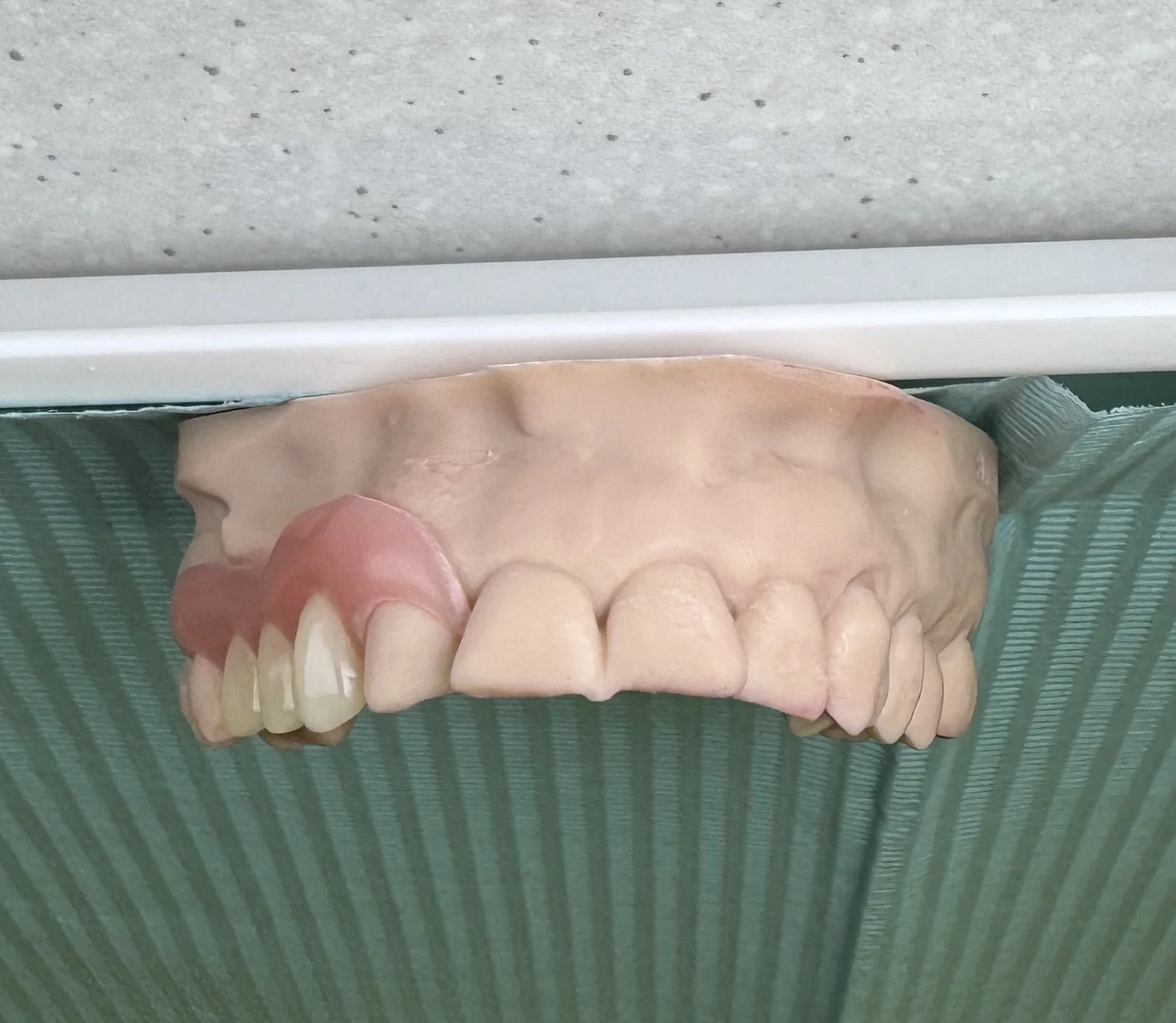 Partial Dentures Sunshine Coast | Dental Prosthetist Darius Northey