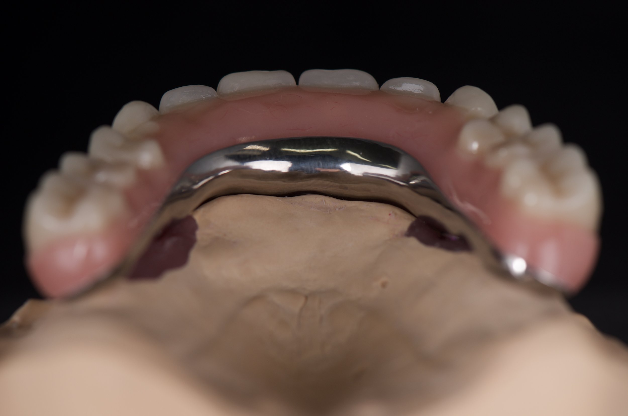 Sunshine Coast Implant Dentures | All Smiles Denture Clinic