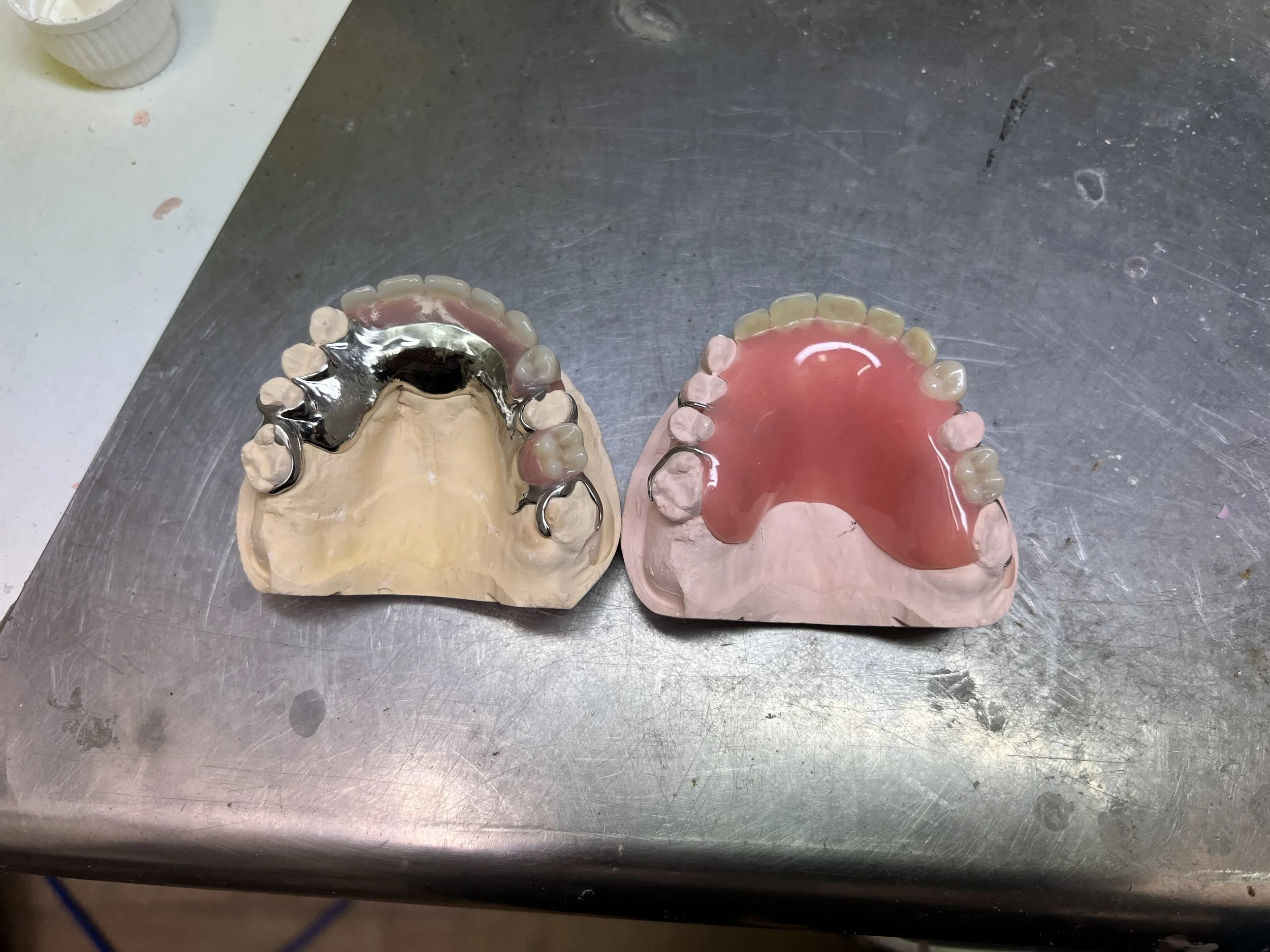 Dentures Sunshine Coast | Best Denture Clinic | All Smiles Denture Clinic