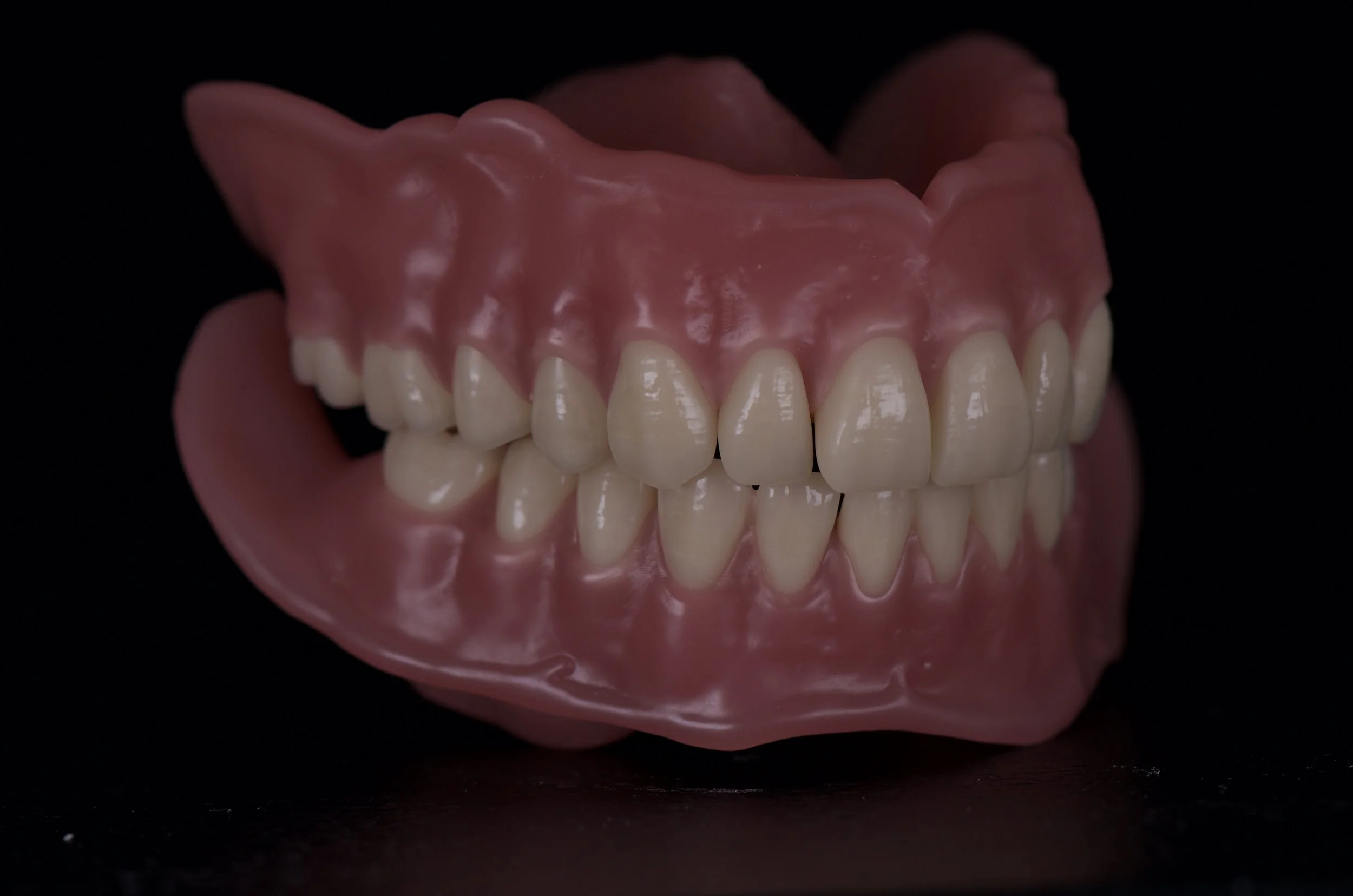 Full Upper and Lower Dentures | All Smiles Denture Clinic