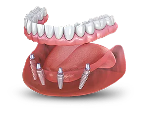 Price image 2