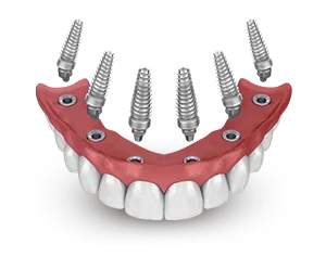 Price image 3