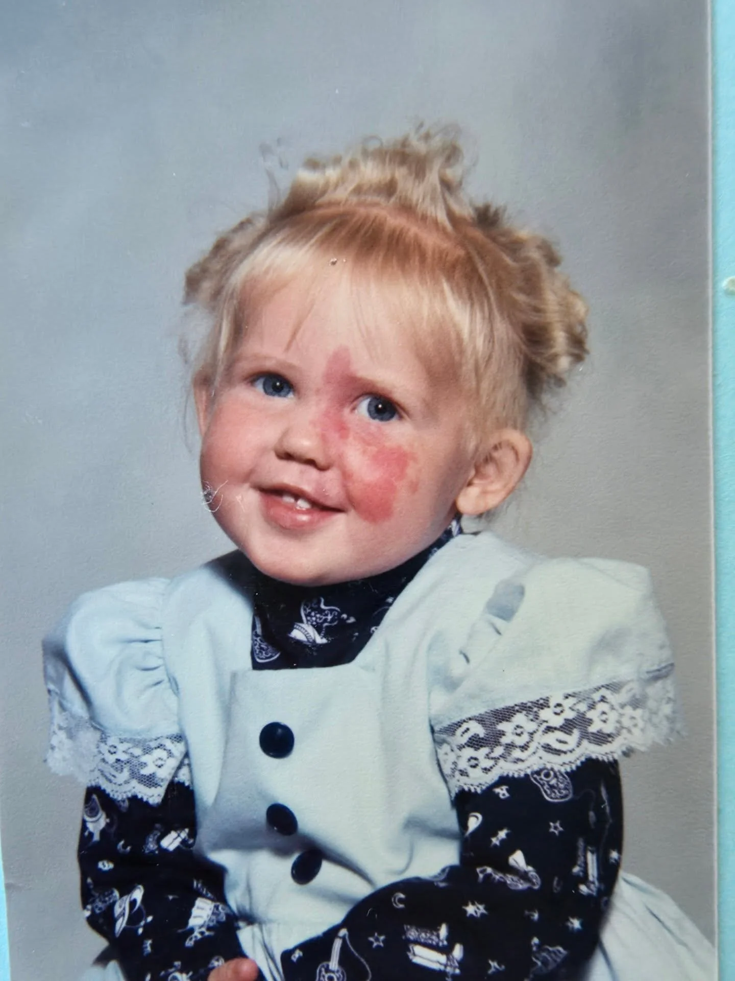 It's international birthmark day!  It's not always sunshine and lollipops when you have a permanent face tattoo from God, somedays I would prefer to just blend in.  But I know I've had doors open and been able to connect with folks I might not have b