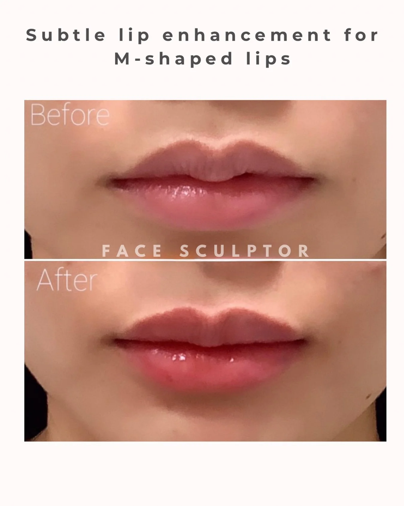 Enhancing, not overfilling 👄