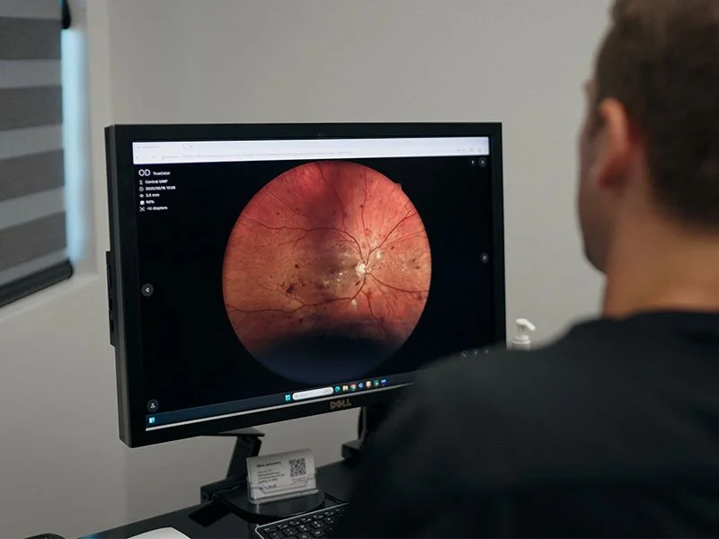 Diabetic Eye Disease and Your Vision