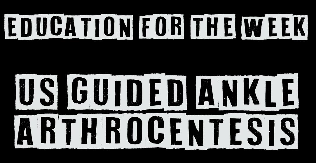 7/22/25: US Guided Ankle Arthrocentesis
