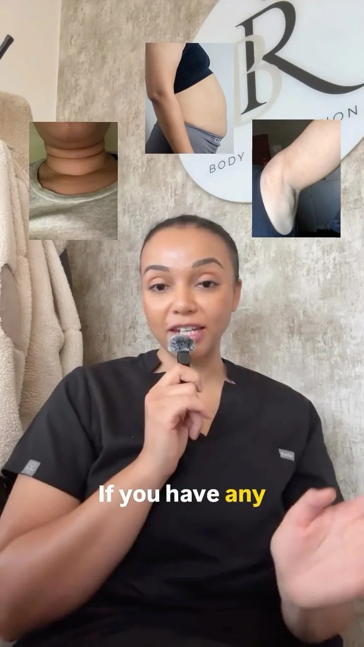 Do you have neck rolls that just won’t shift, bloating that never seems to go away, or puffiness under your arms or legs? π
It’s probably not weight gain — it’s your lymphatic system telling you it needs a reset.
When your l