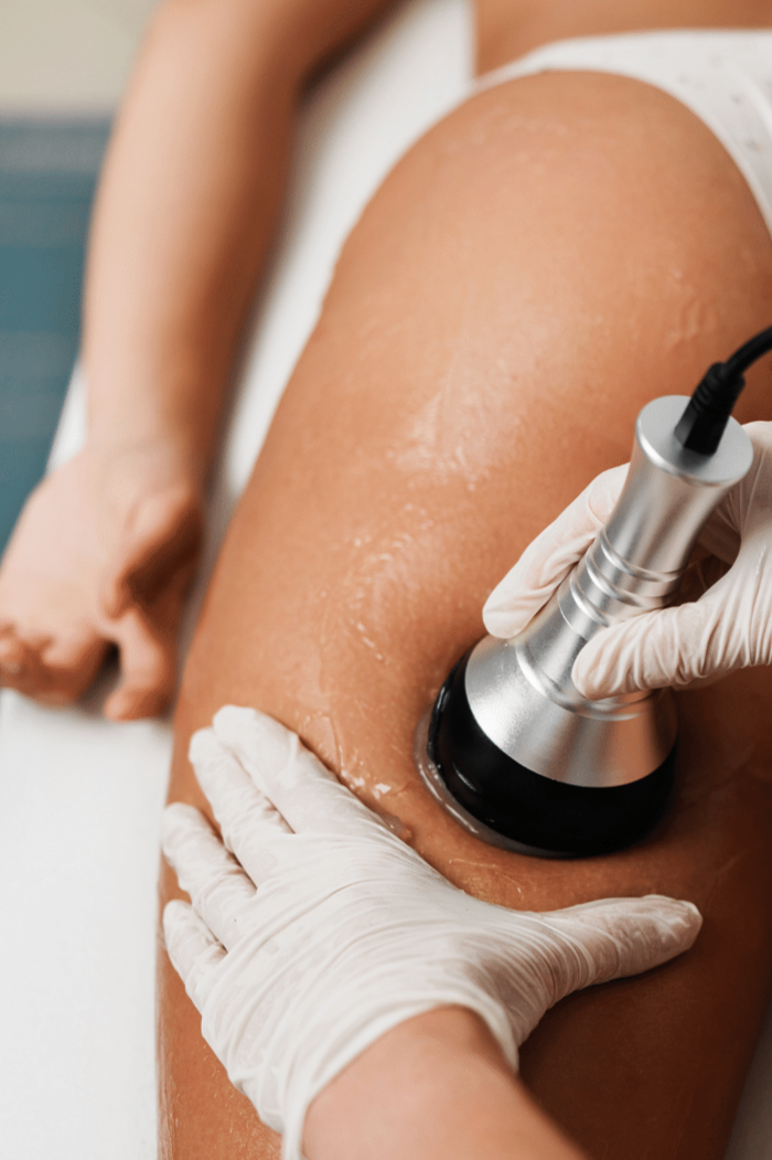 Leeds booty lift treatment