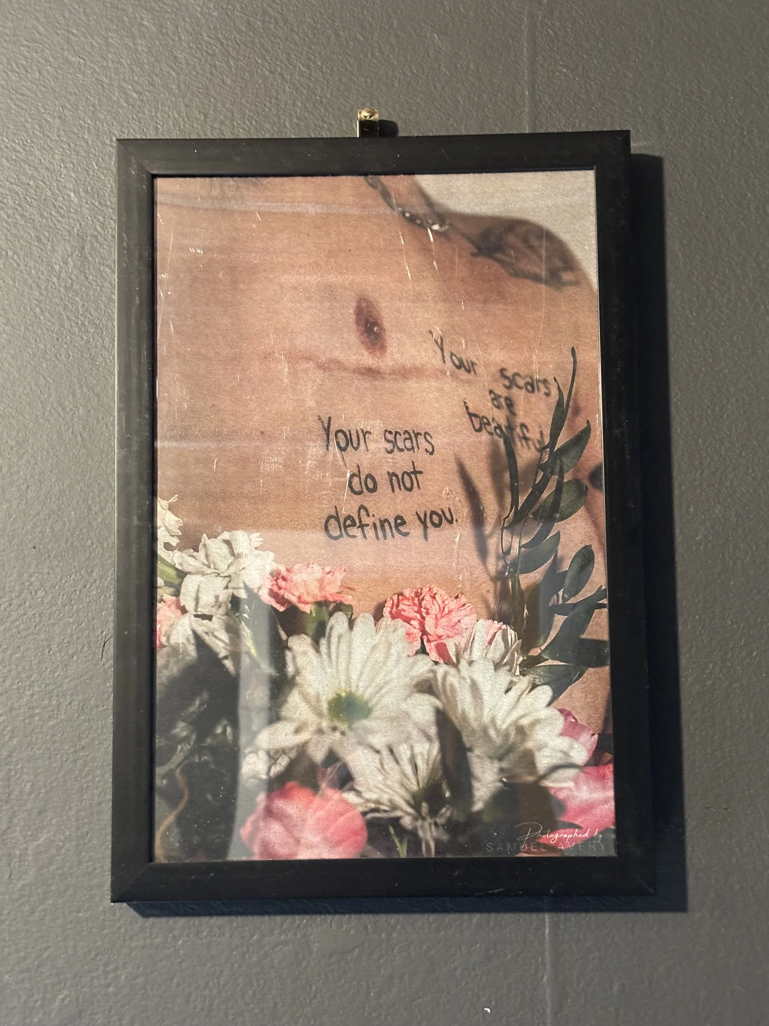 "Your Scars Do Not Define You" Framed Print