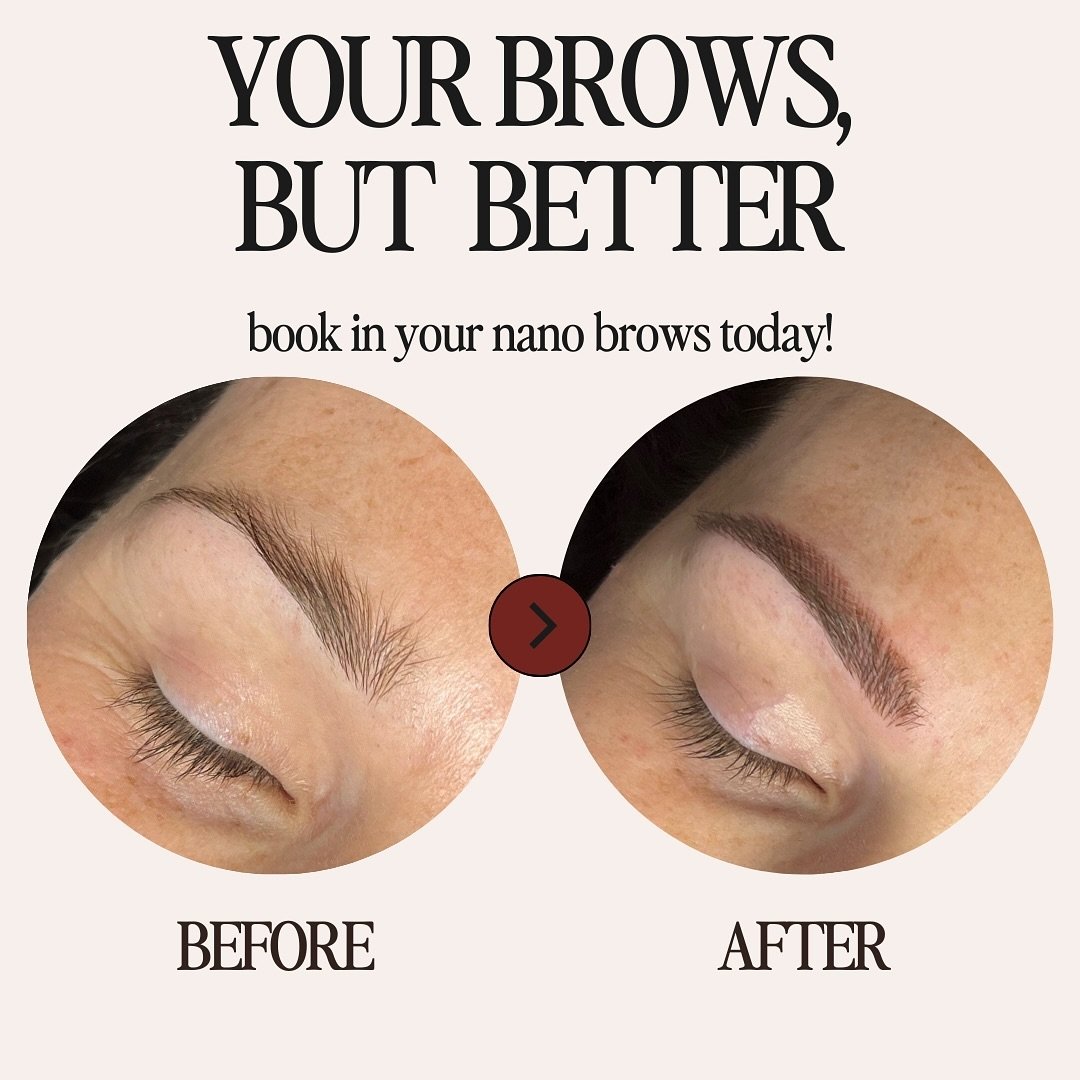 Imagine waking up everyday and not having to stress about doing YOUR BROWS. For a select few of us&hellip; it sounds like a dream but it&rsquo;s totally possible!

Losing brow hair to aging? We can help

Dream of thicker brows? We can provide them th