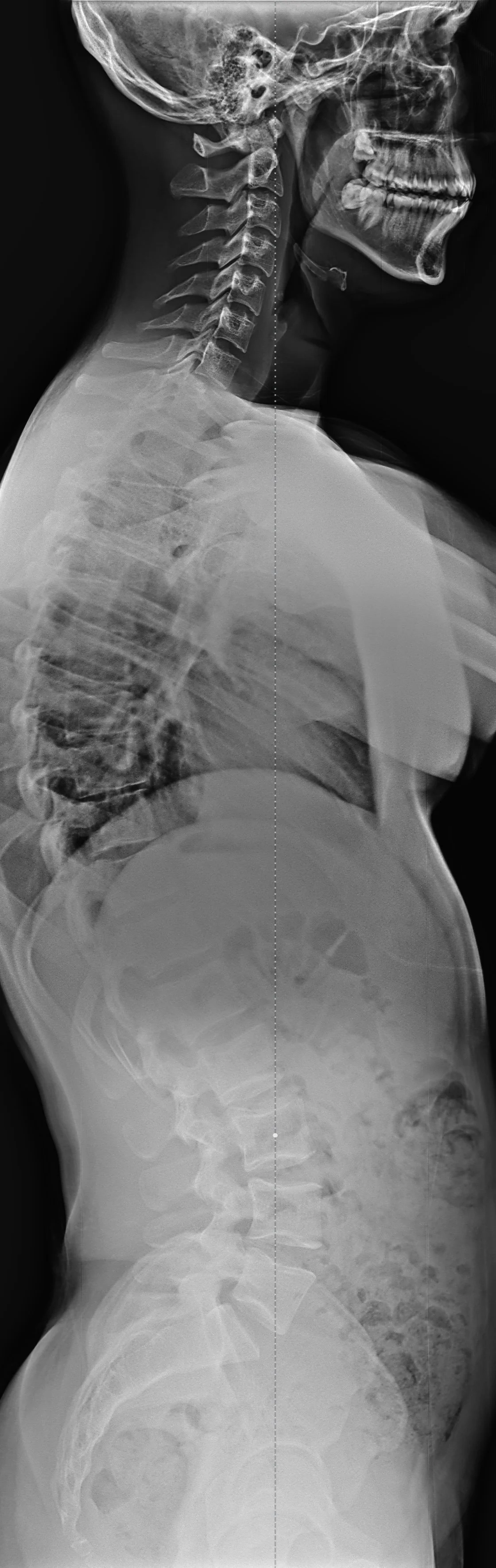 Dr. Victoria explaining x-ray findings to patients.