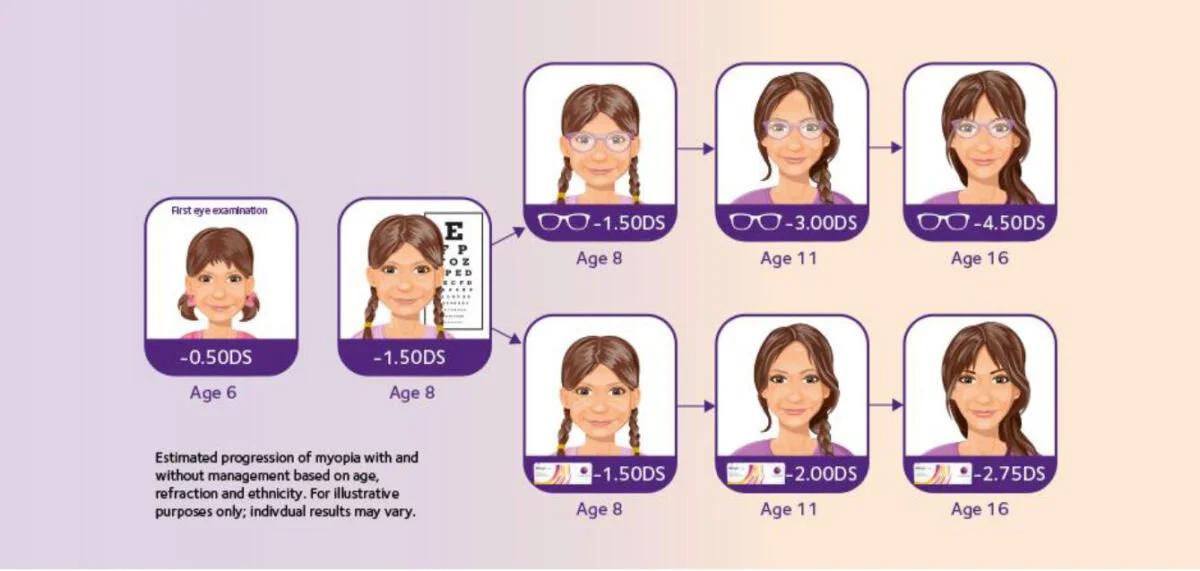 Myopia Progress Myopia Explained — Expert Eye & Ear Care, Arthur Hayes Opticians