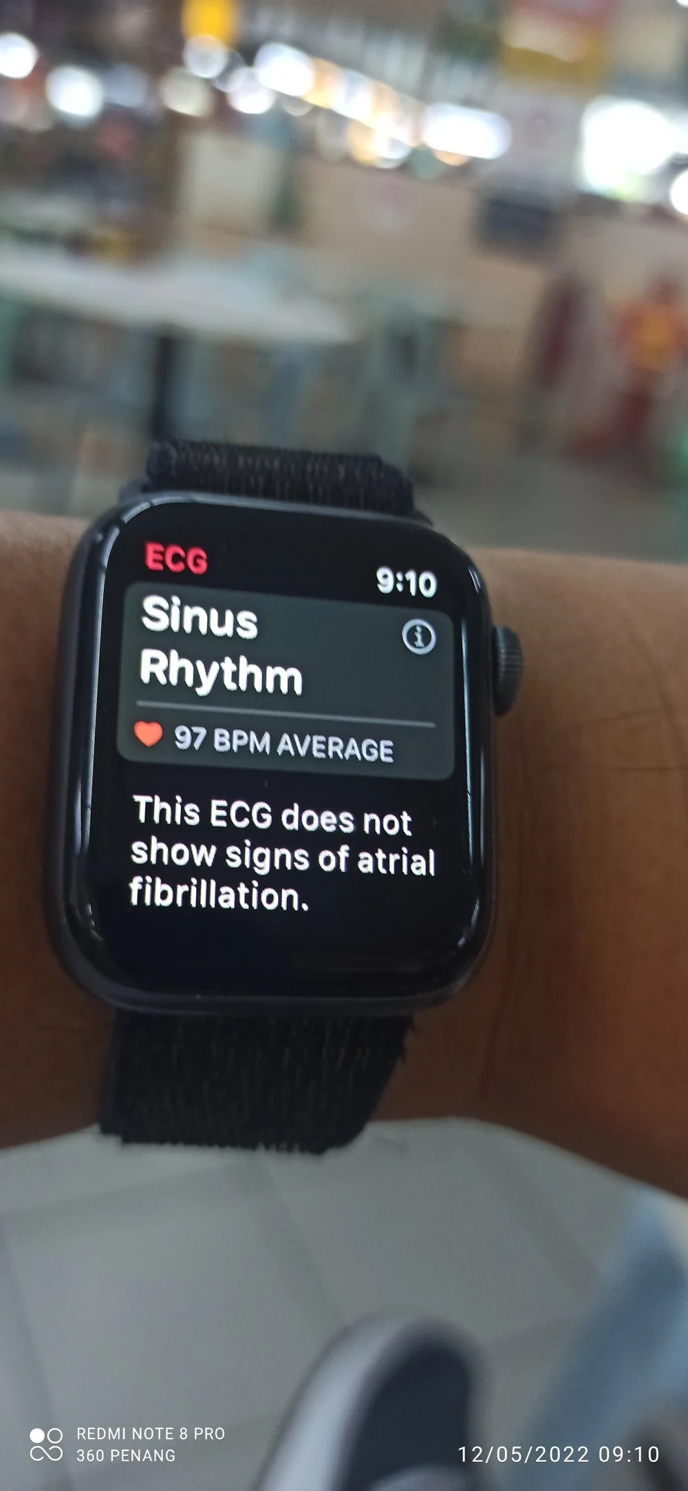 Review of ECG app @Apple Watch 4