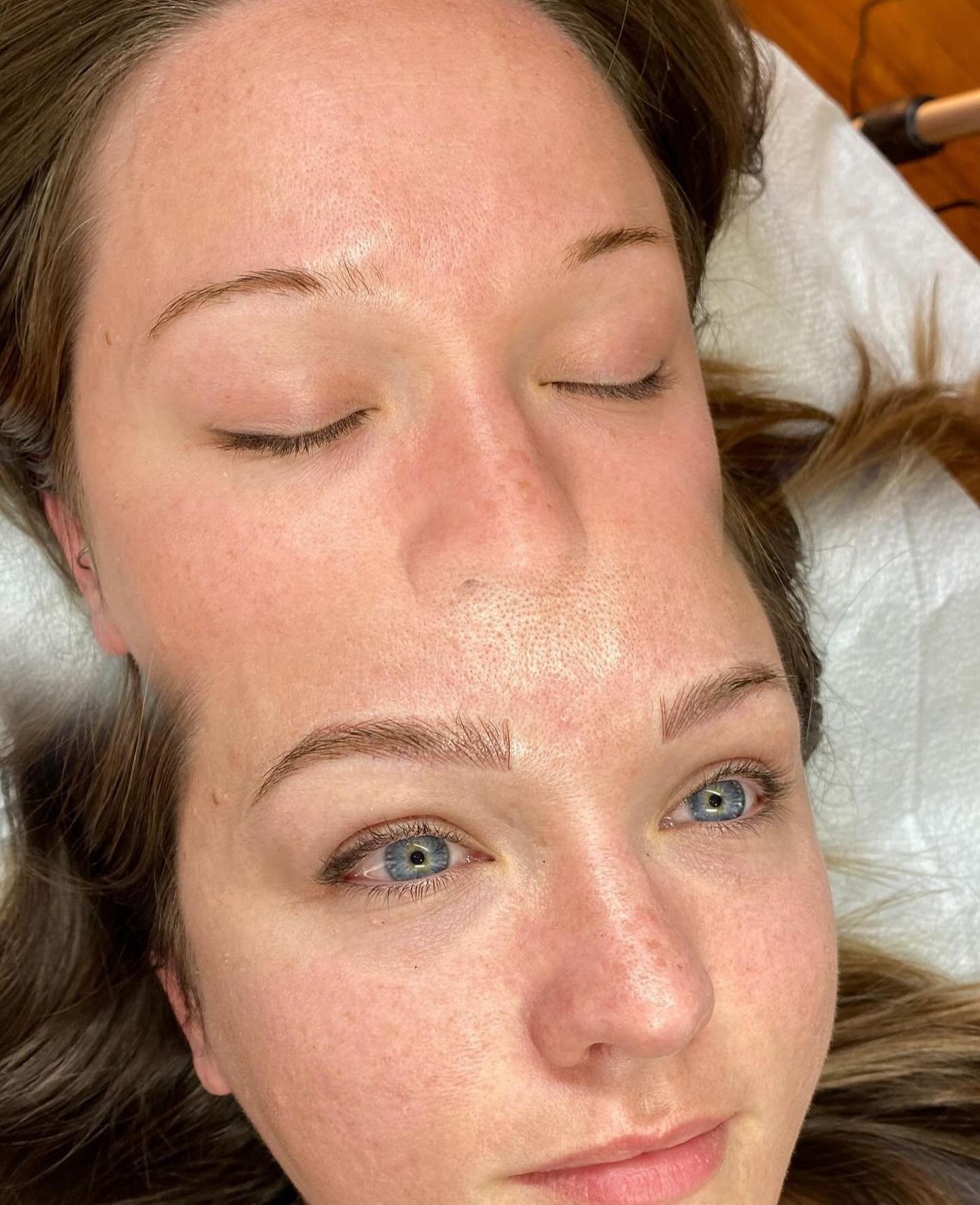 For this stunning clients first session, Shelby focused on crafting the perfect shape with microblading and enhancing depth with light shading. Stay tuned for session two where she will elevate the look with adding more texture and density. 

Artist:
