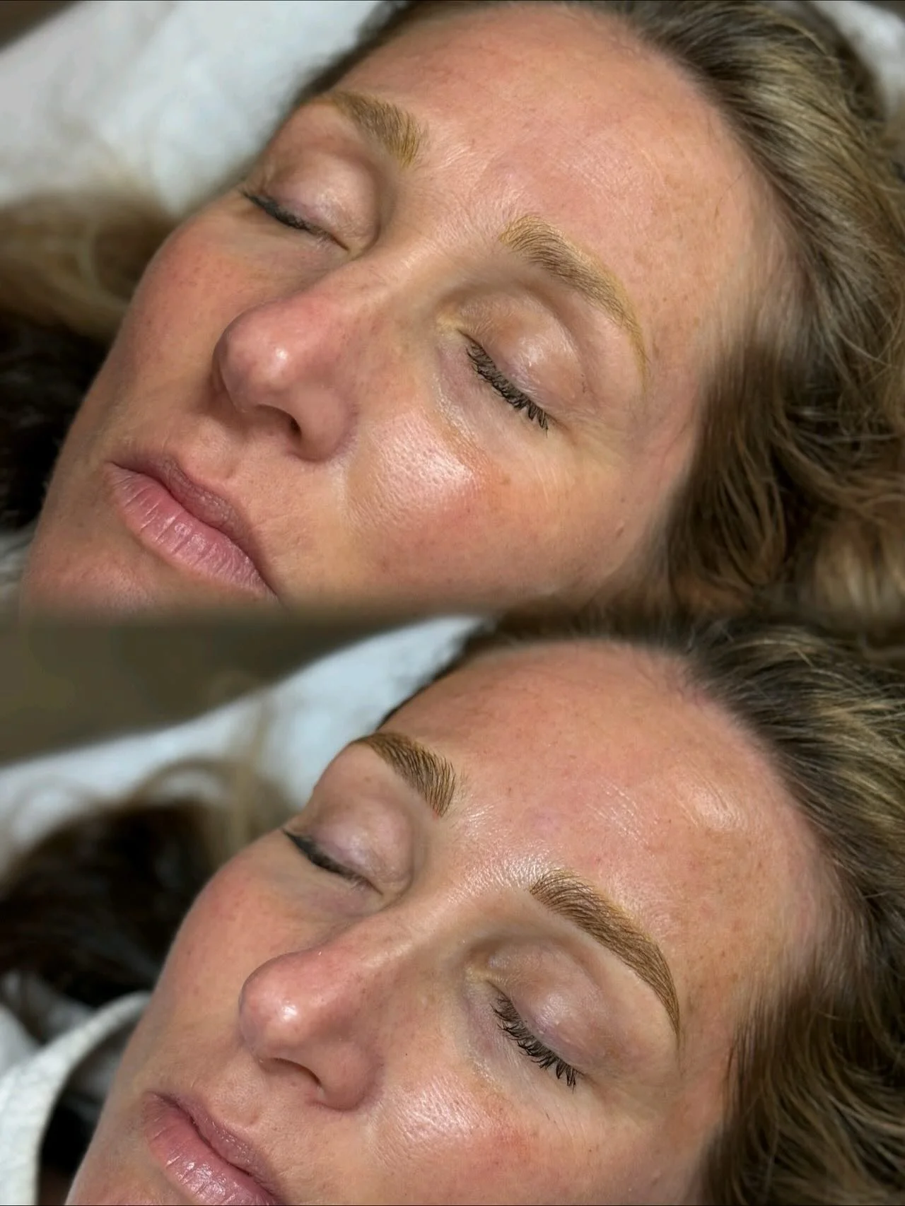 ✨ Fresh start, fresh brows! ✨
These stunning combo brows were created after full laser tattoo removal — proof that beautiful, natural results are possible with a clean canvas. Soft shading and delicate strokes bring back balance, shape, and con