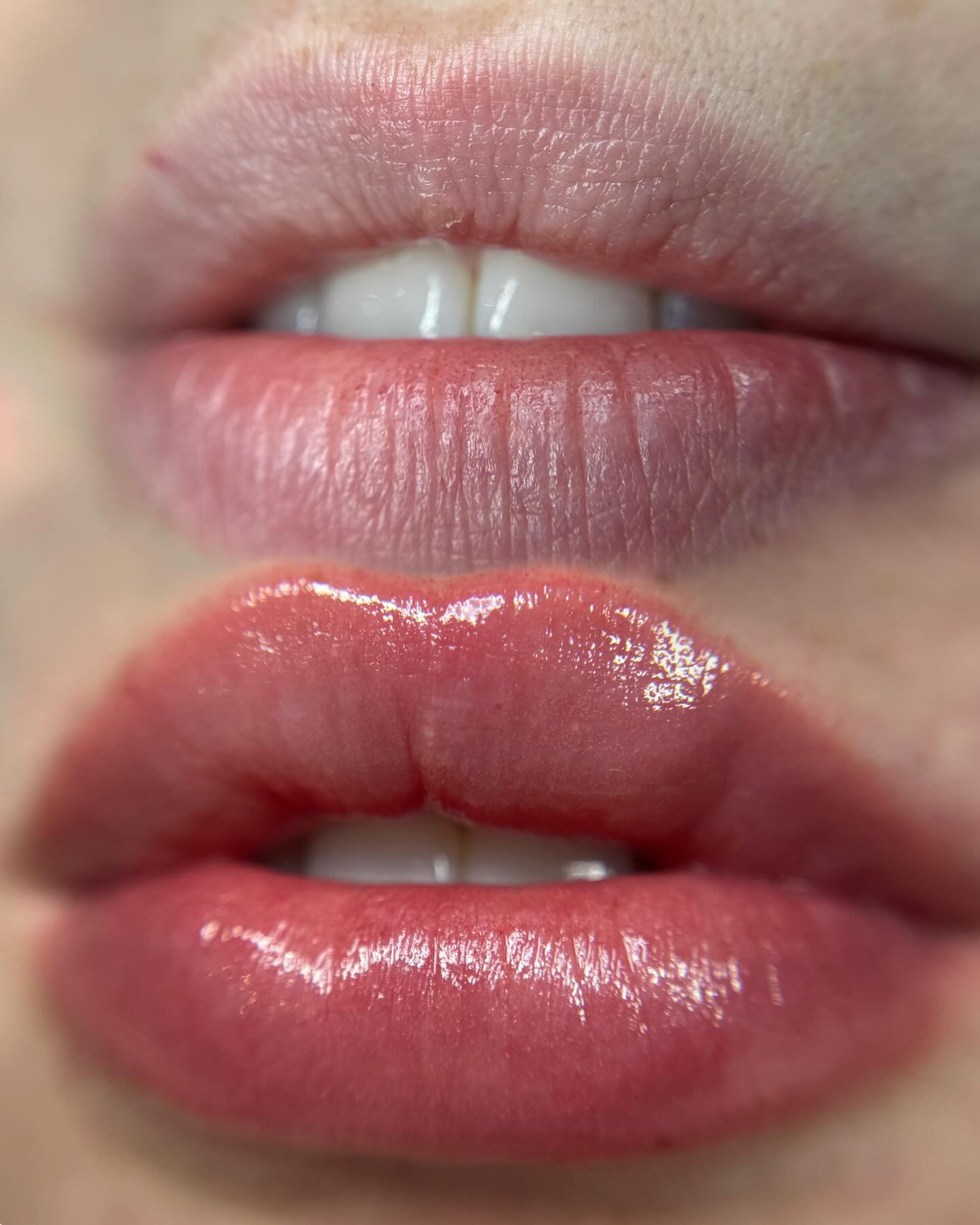 Soft, natural lip blush that enhances her lip tone without looking overdone 🤍
Just enough color to add definition, balance, and a fresh, effortless look.

Artist: Stephanie 
Service: Lip Blush

#alteredaesthetics #raleighnc #beauty #lipblush #natura