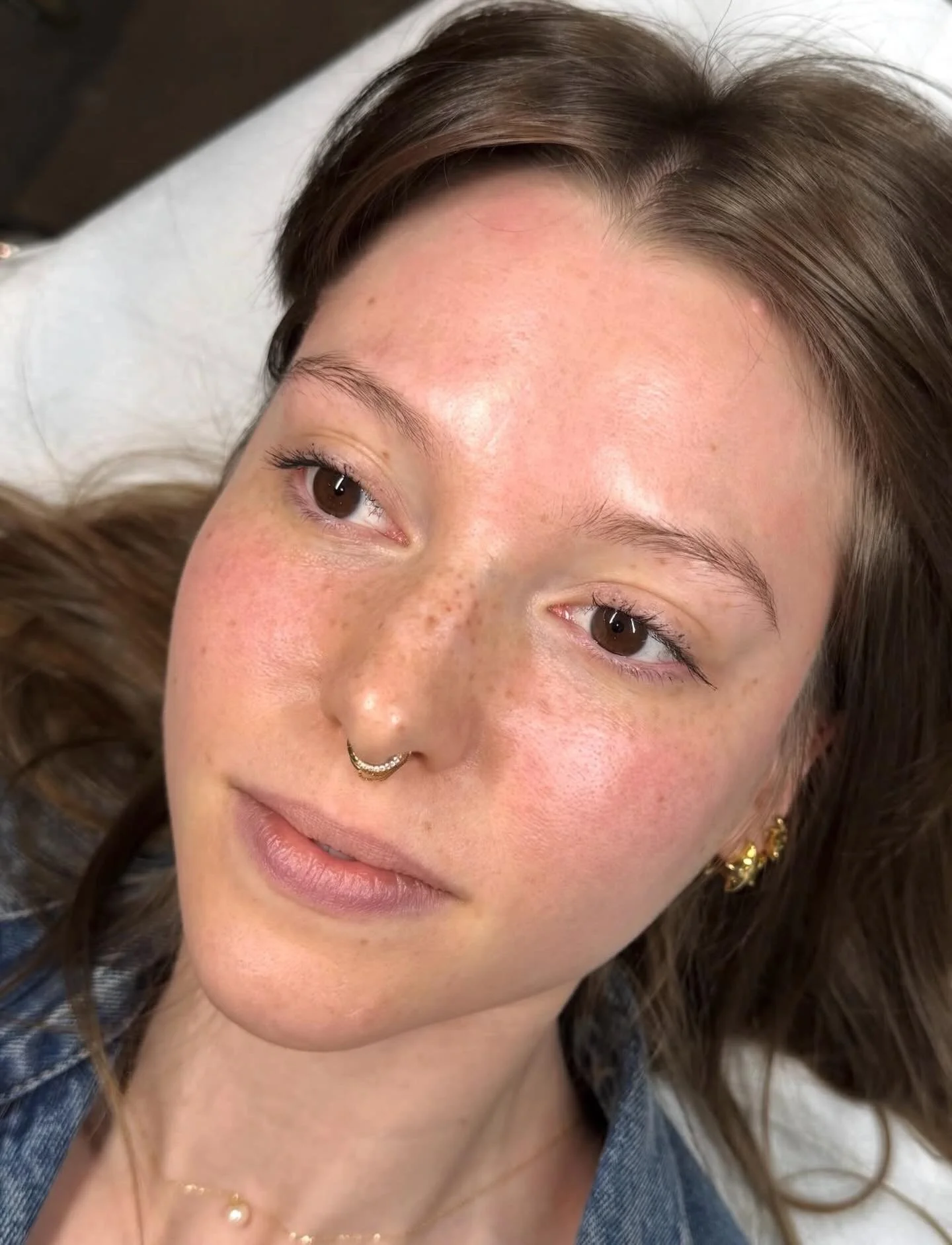 Soft, sun-kissed freckles that look like they&rsquo;ve always been there 🤍✨ Healed results fade into the skin beautifully, giving that effortless, natural glow without ever looking overdone. The kind of detail that makes people wonder if they&rsquo;