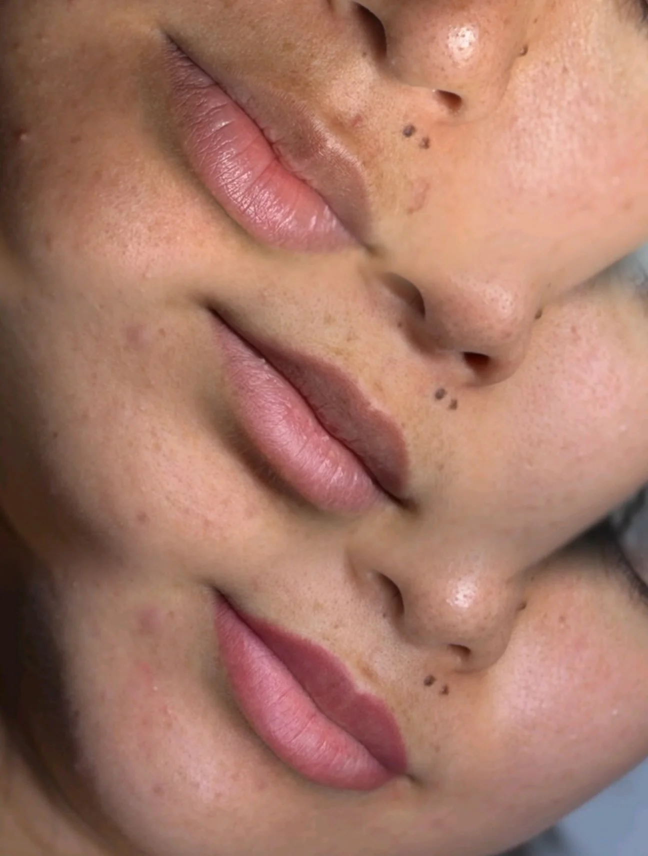 Proof that the touch-up is where the magic 🪄settles in.

Before (top), healed after session one (middle), and healed after touch-up (bottom), with a touch of neutralization to balance her natural tones. 

Soft, even, rosy color that looks like her l