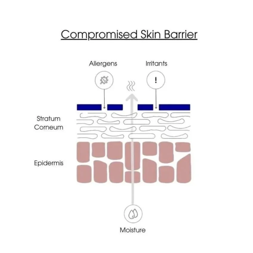 How to Repair a Compromised Skin Barrier. An Expert Guide to Healthy, Resilient Skin