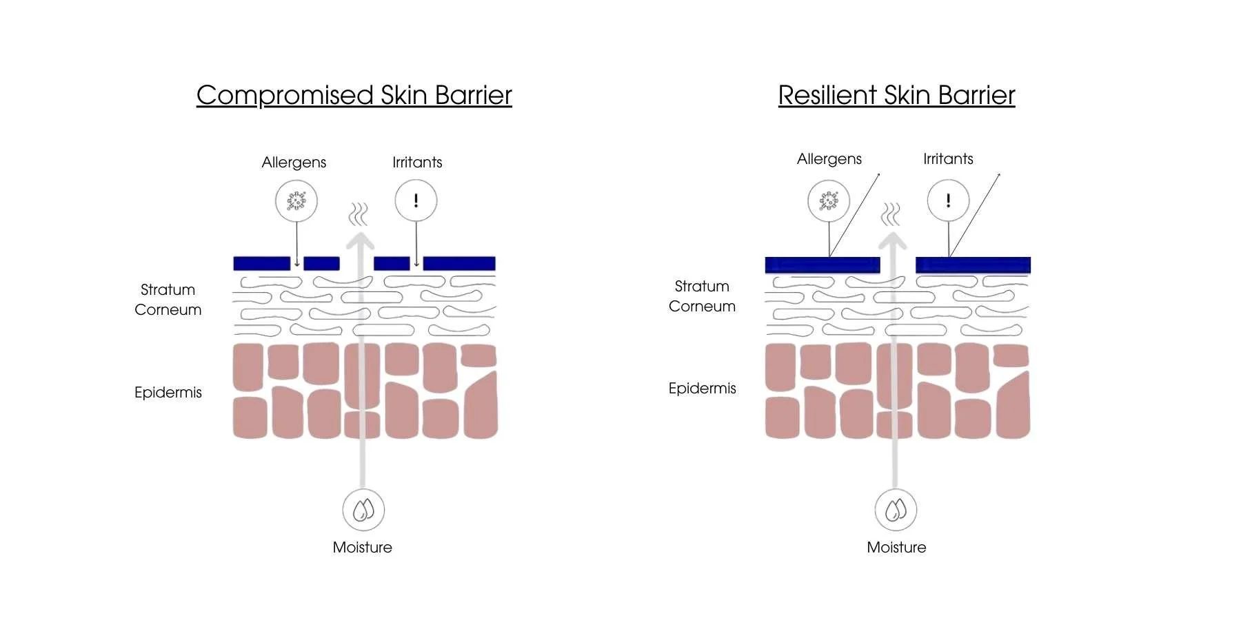 Diagram of a compromised versus a resilient skin barrier