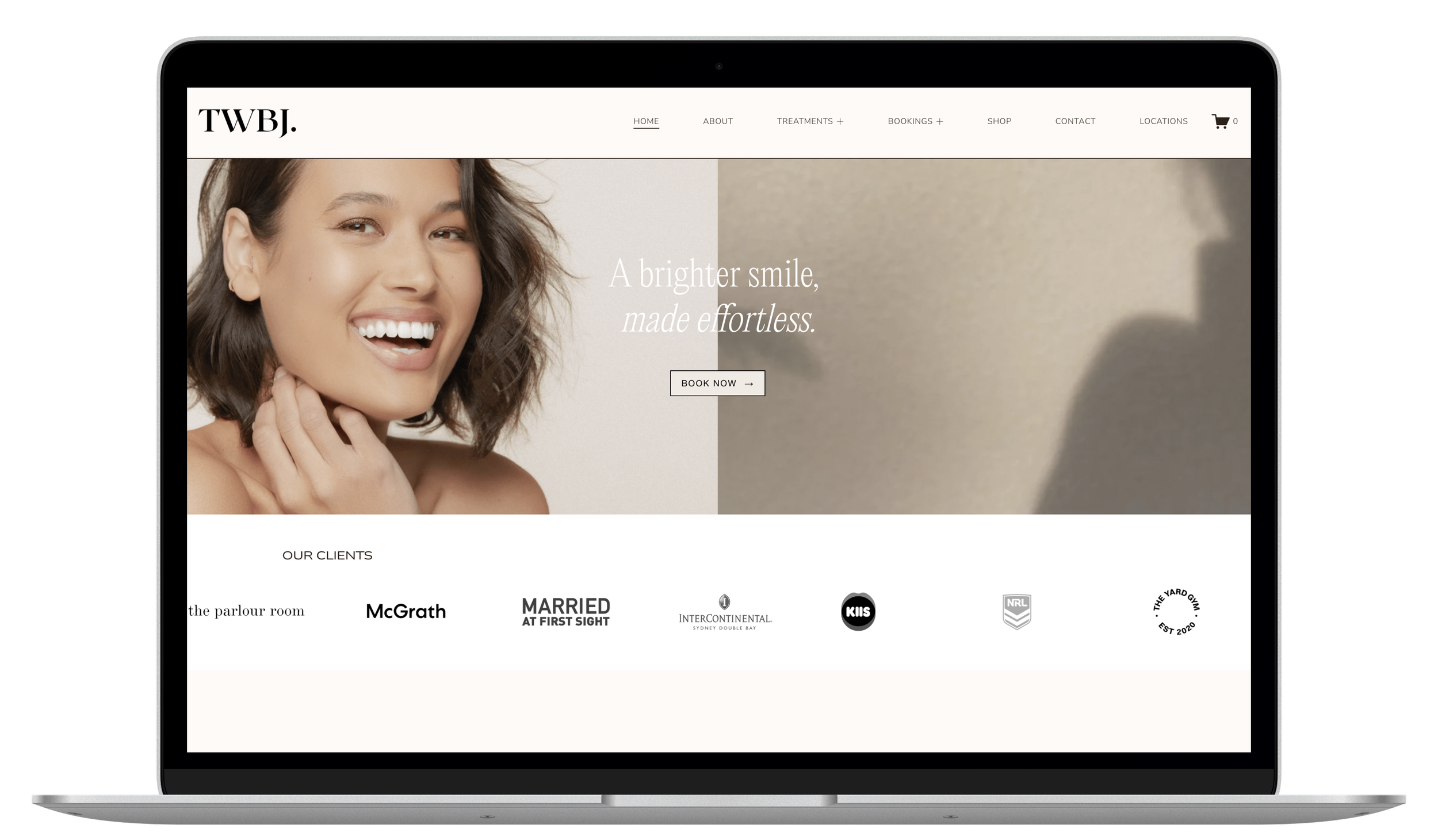 Laptop displaying a website with a headline that says a brighter smile, made effortless with a women smiling.