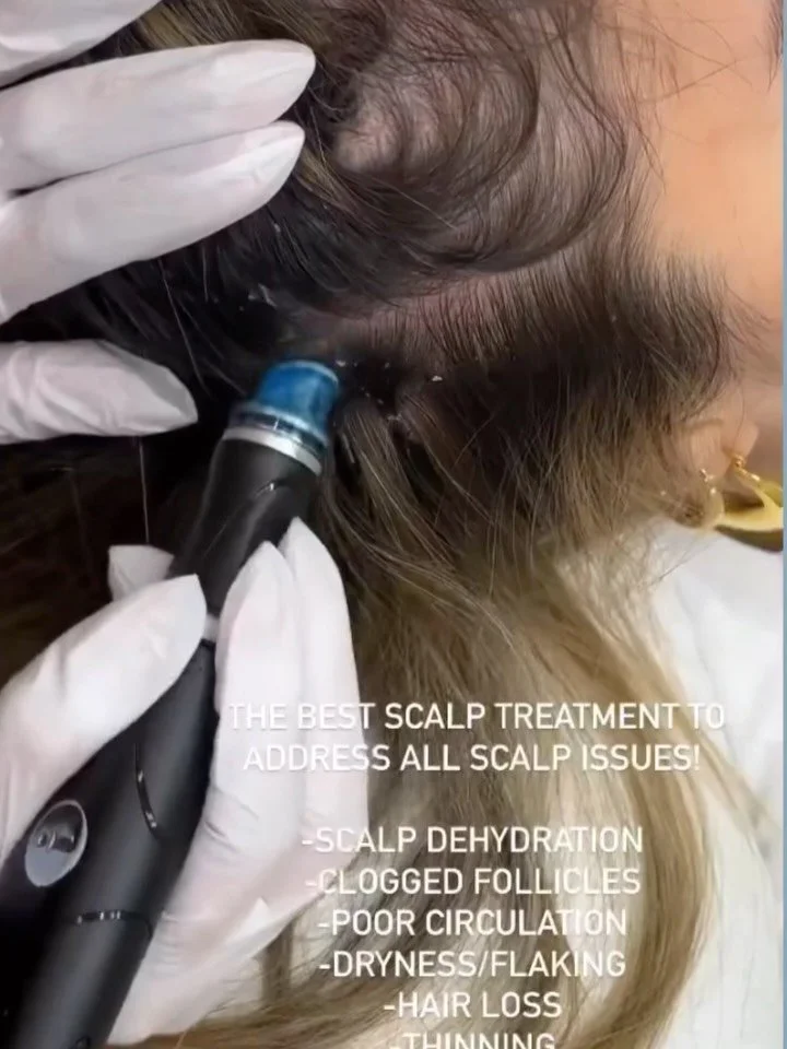 Meet Keravive, a Hydrafacial for your scalp✨