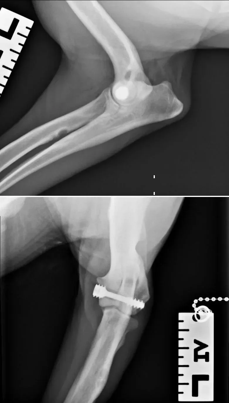PVS Humeral Condylar Fissure