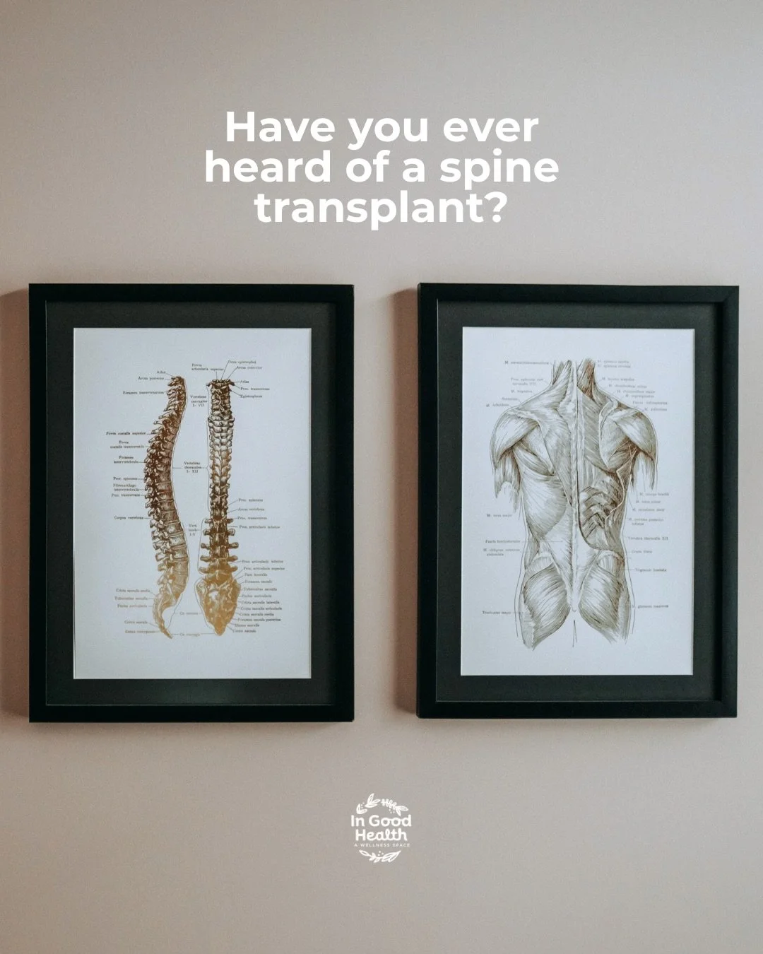 Spine transplant? If only... 🤪

Let this be your reminder to take good care of the one you&rsquo;ve got &mdash; or give us a call and we&rsquo;ll show you how! 😉

#ingoodhealth #ingoodhealthkomoka #chiropractor #chiropractic #chiro