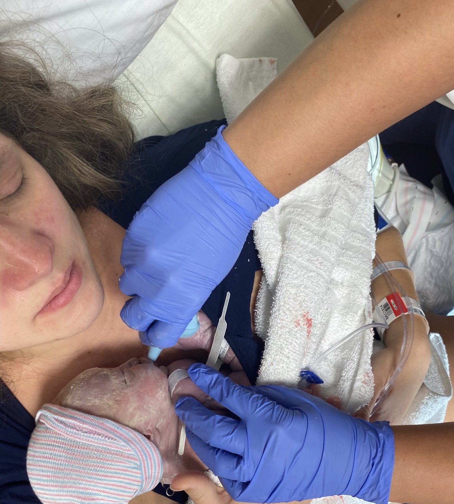 Newborn baby covered in vernix, fresh from the womb, laid on the mother's chest. The nurse's gloved hands are clearing the baby's nose.