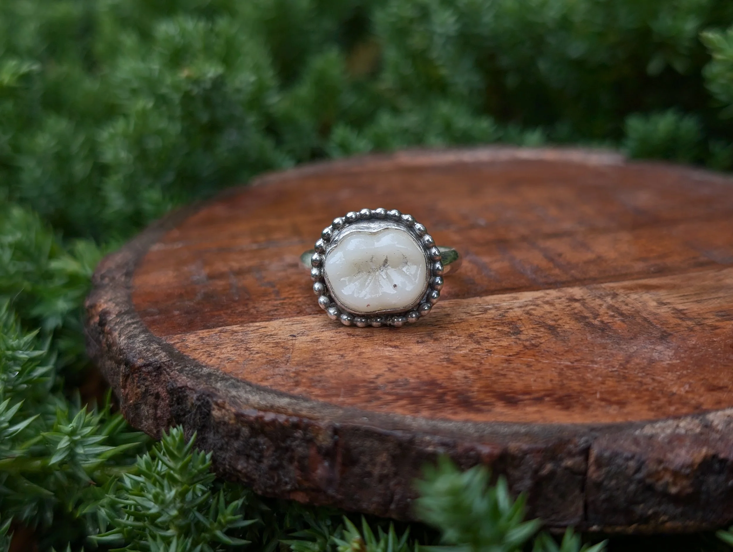 Porcelain Tooth OR Ring!